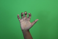 Bent 5- 4 fingers bent down, thumb extended to the side